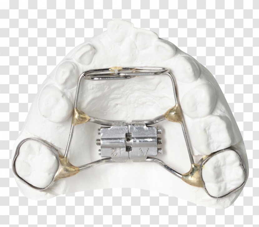 Orthodontics Tooth Clear Aligners Retainer Dental Braces - Tongue Transparent PNG