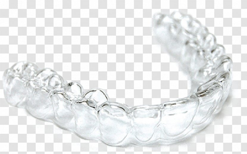 Clear Aligners Dentistry Orthodontics Dental Braces Tooth - Sealant - Dentist Transparent PNG