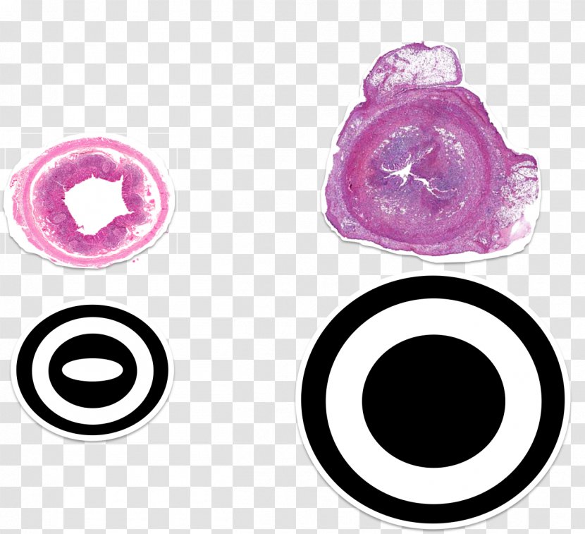 Appendicitis Ultrasonography Emergency Medicine Histology - Body Jewelry - Una Morte Semplice Transparent PNG