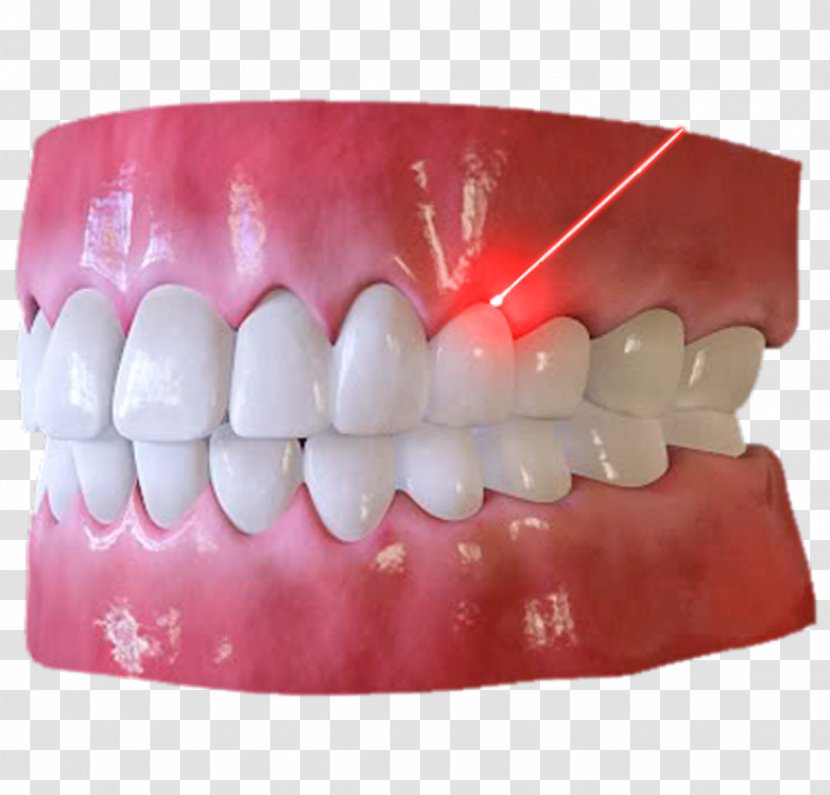 Tooth - Jaw Transparent PNG