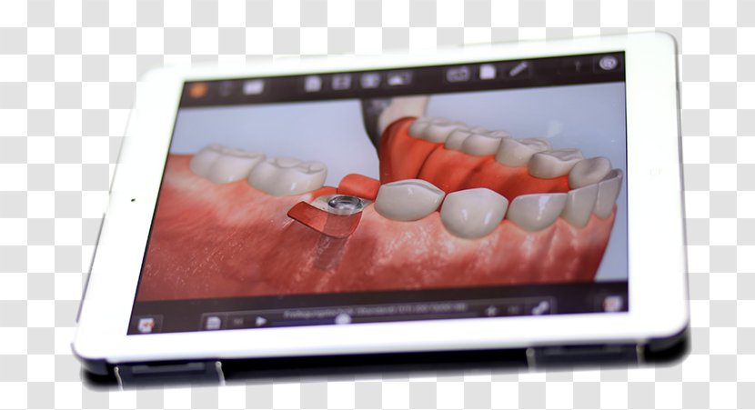 IPad 2 Netbook Dentist Implantology Dental Implant - Apple - Doctor With Ipad Transparent PNG