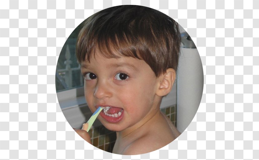 Cheek Tooth Decay Child Fluorine - Chin Transparent PNG