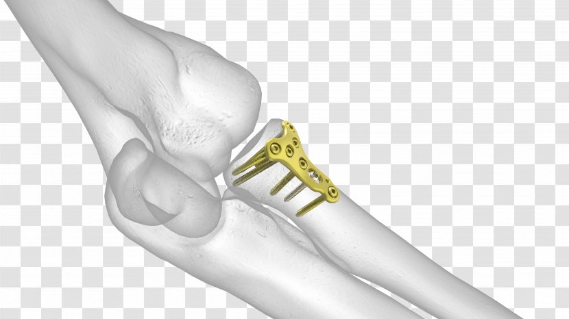 Thumb Elbow Radius Humerus Joint - Hand - Head Of Transparent PNG