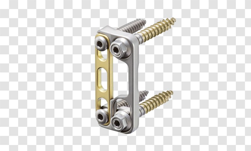 Golden Gate Bridge Vertebral Column Lumbar Vertebrae Business