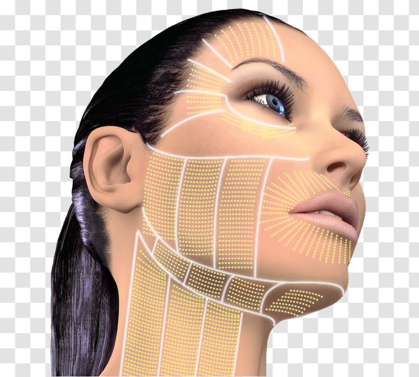 High-intensity Focused Ultrasound Surgery Rhytidectomy Skin Wrinkle - Face Transparent PNG