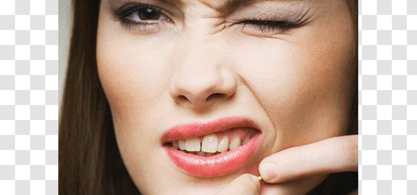 Acne Pimple Comedo Skin Care Health Transparent PNG