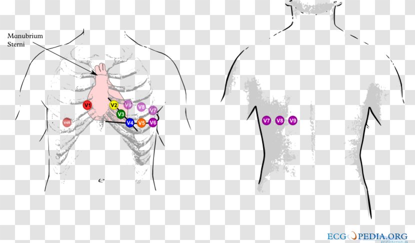 Electrocardiography Introduction To 12-Lead ECG: The Art Of Interpretation Infarction Sinus Rhythm Wiring Diagram - Silhouette - ECG Lead Placement Transparent PNG