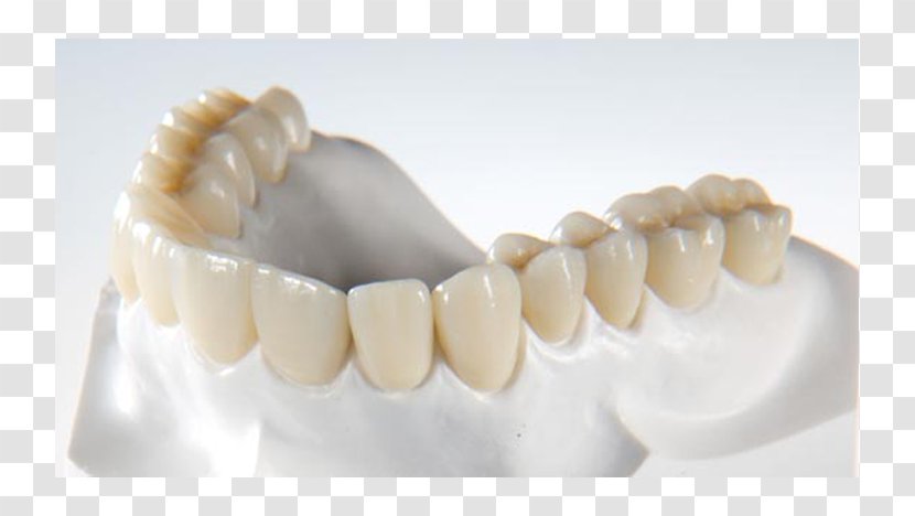 Crown Zirconium Dioxide CAD/CAM Dentistry Dental Laboratory - Human Tooth Transparent PNG