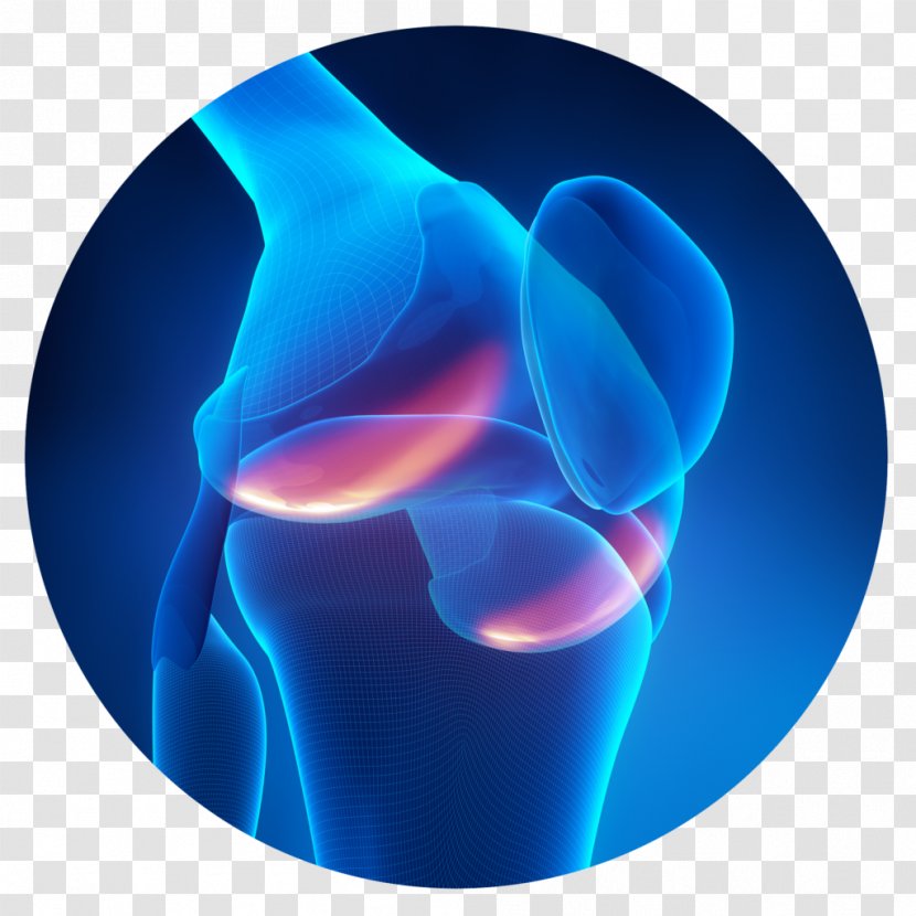 Knee Pain Bone Joint - Osteoarthritis - Ache Transparent PNG