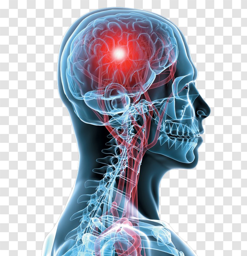 Nerve Traumatic Brain Injury Concussion Medicine - Cartoon Transparent PNG