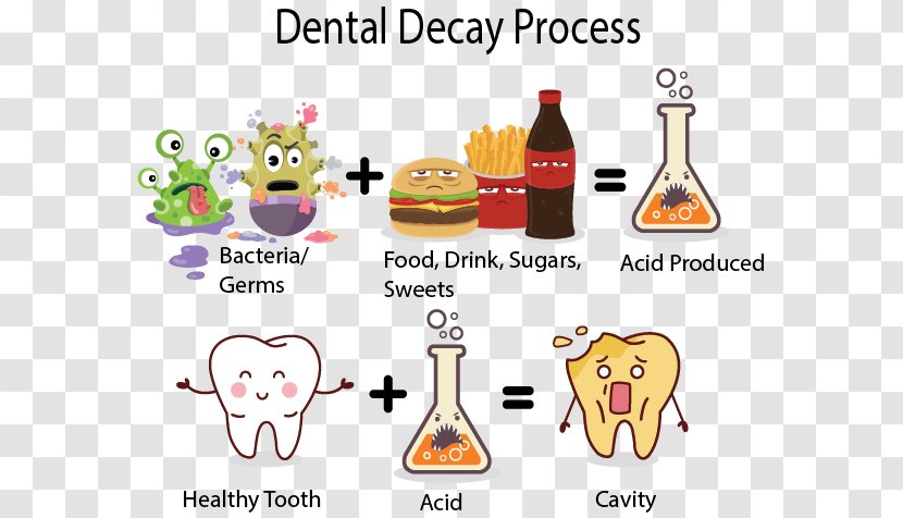 Tooth Decay Human Dentistry Enamel - Dental Caries Transparent PNG