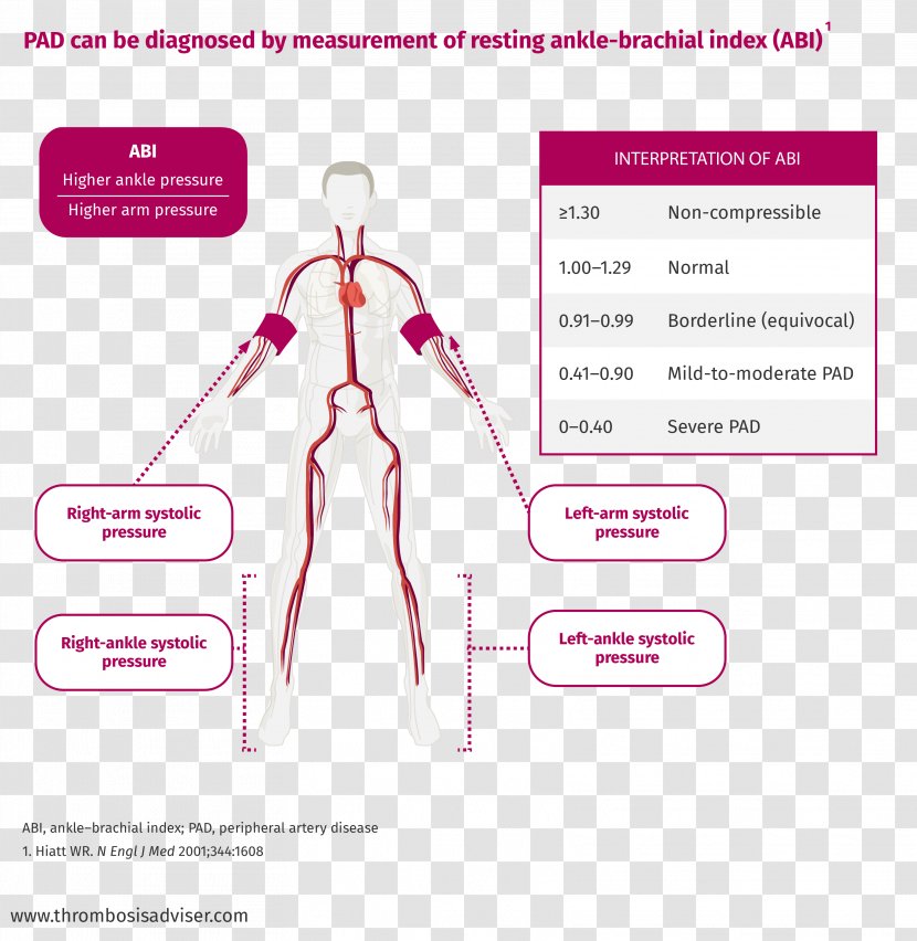 Peripheral Artery Disease Ankle–brachial Pressure Index Vascular System Medical Diagnosis - Frame - Cartoon Transparent PNG