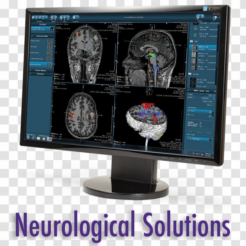 Customer Patient Resource Medicine - Advertising - Rebound Orthopedics Neurosurgery Transparent PNG
