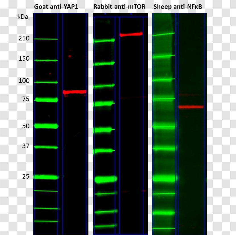 Immunoglobulin Light Chain Immunoprecipitation Western Blot G Immunology - Polyacrylamide Gel Electrophoresis - Antibody Images Transparent PNG