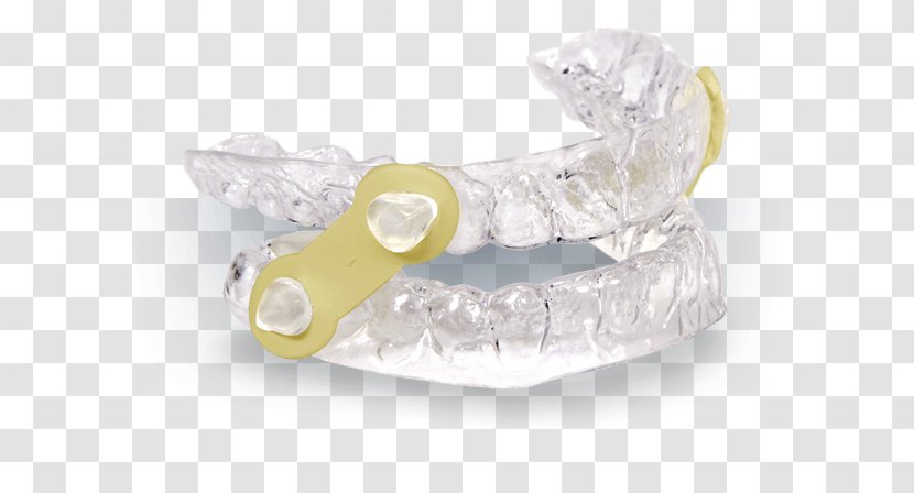 Mandibular Advancement Splint Mandible Dentistry Snoring Jaw Transparent PNG