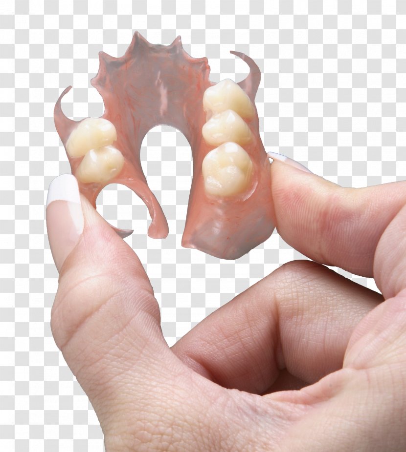 Dentures Dental Laboratory Dentistry Removable Partial Denture - Jaw Transparent PNG