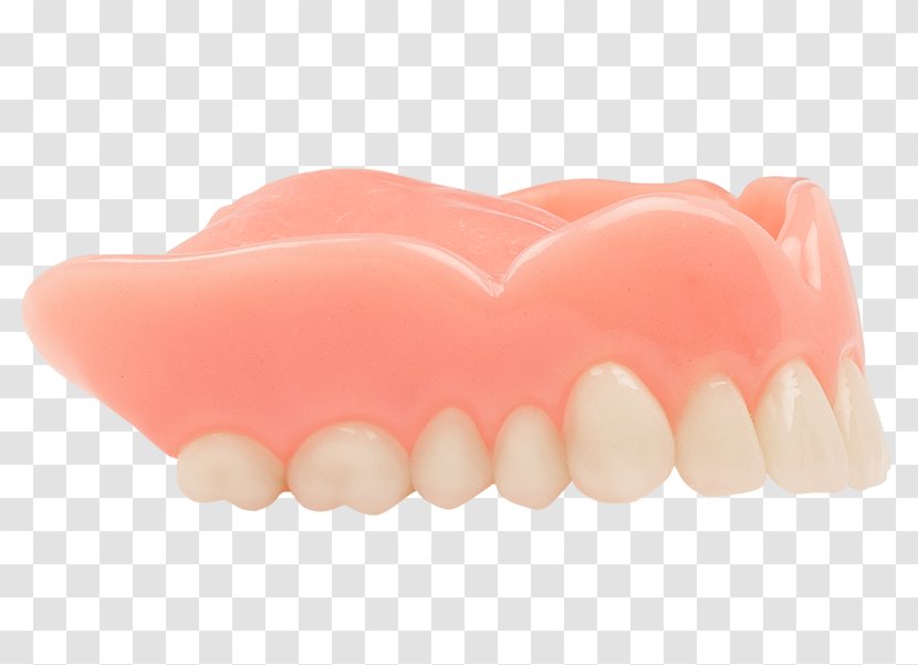 Dentures Tooth Dentistry Gums Removable Partial Denture - Information - Jaw Transparent PNG