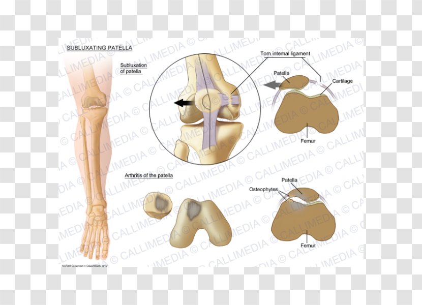 Patella Subluxation Bone Shoulder Pulled Elbow - Silhouette - Tear Transparent PNG