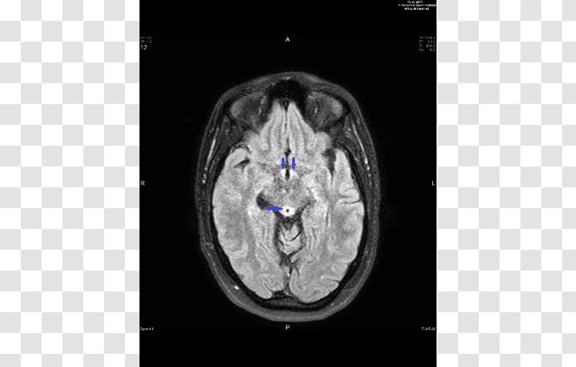 Computed Tomography Spinal Cord Sagittal Plane Internal Medicine - Surround Transparent PNG