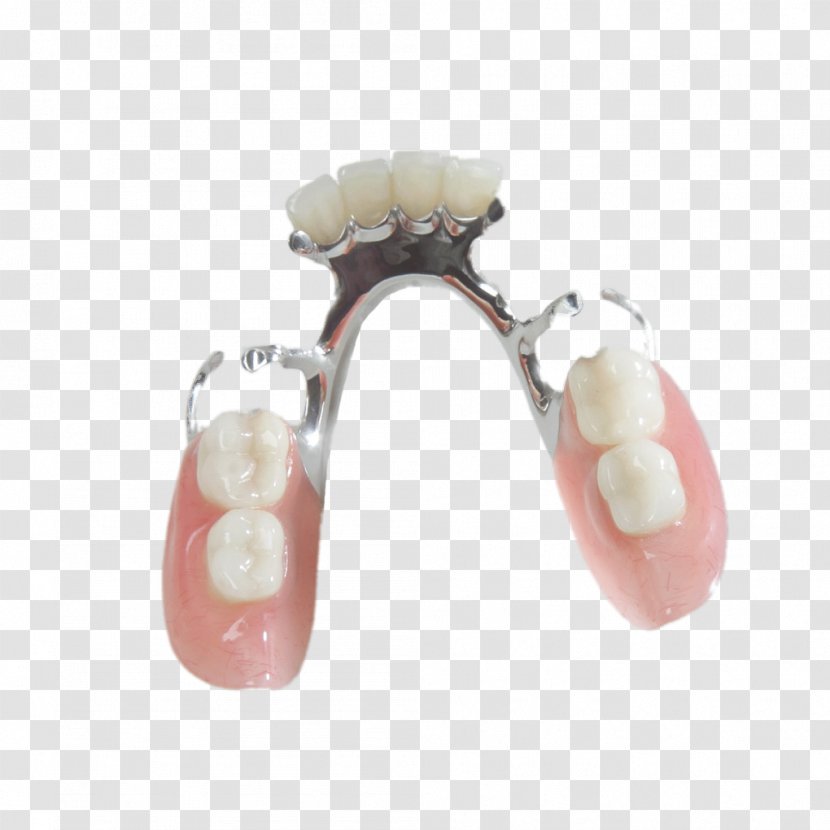 Tooth Dentures Prosthesis Removable Partial Denture Dentistry - Crown Transparent PNG