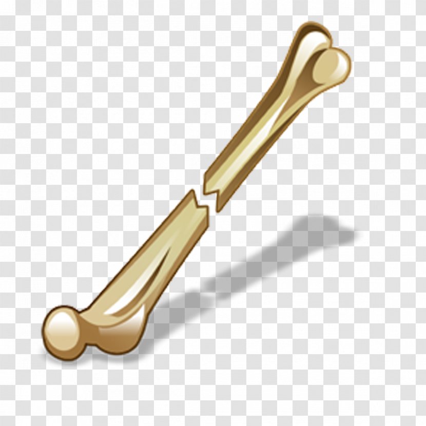 Bone Fracture Icon - Metal - Broken Bones Transparent PNG