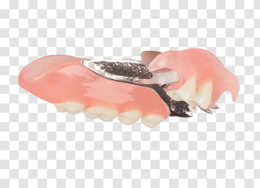 Removable Partial Denture Dentures Mouth Dentistry Tooth - Finger - Top Angle Transparent PNG