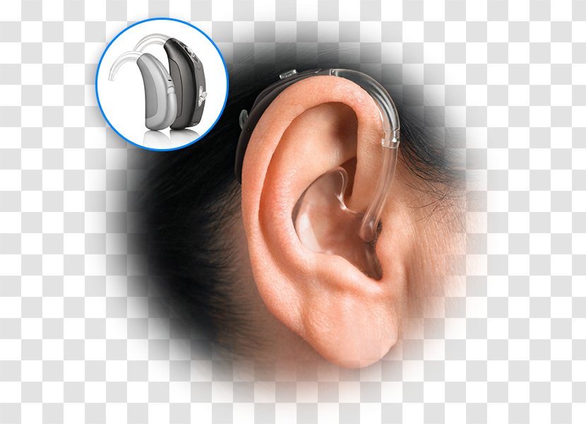 Hearing Aid Earmold Audiology - Boneanchored - Ear Transparent PNG