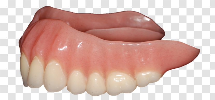 Dentures Human Tooth Transparent PNG
