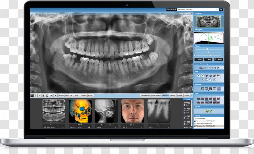 Dentistry Medicine Medical Imaging Dental Radiography Computer Monitors - Jaw - Multimedia Transparent PNG