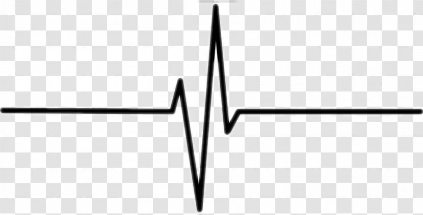 Electrocardiography Clip Art Pulse Vector Graphics - Heart Arrhythmia Transparent PNG