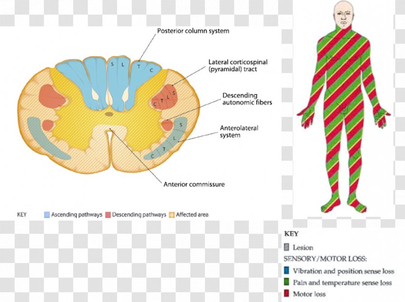 Graphic Design Neuroanatomy Neuroscience Brain Ache - Cartoon - Fecal Incontinence Transparent PNG