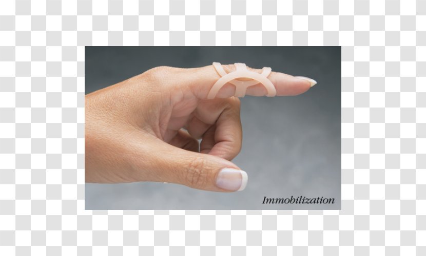 Thumb Splint Swan Neck Deformity Mallet Finger Boutonniere - Hand Transparent PNG