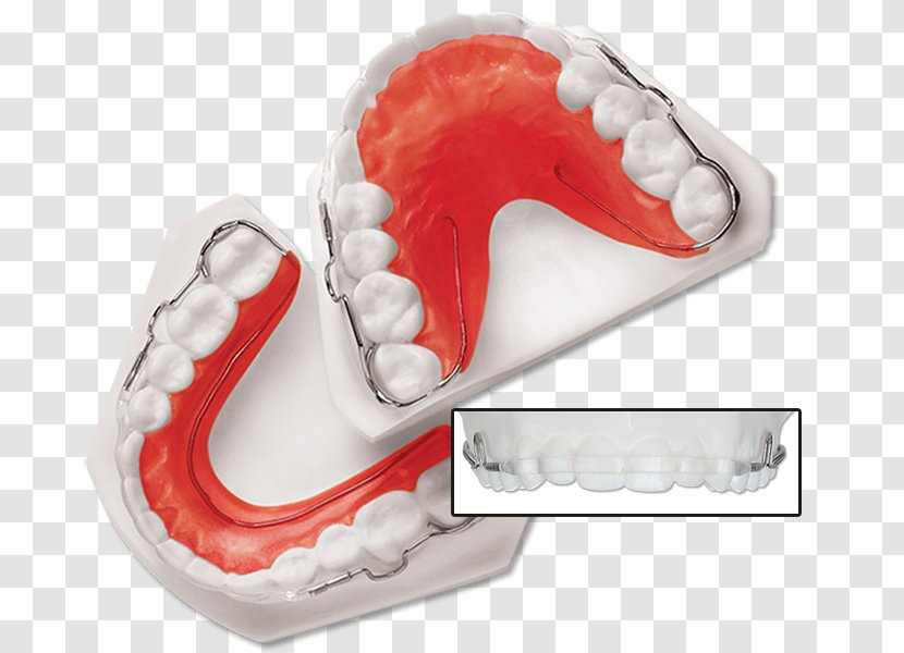 Tooth Retainer Orthodontics Dentistry Dental Braces - Mandible Transparent PNG