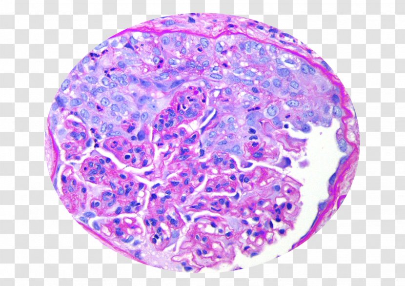 Renal Pathology Download - Lilac - Kidney Transparent PNG