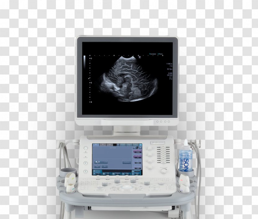 Ultrasound Ultrasonography Medicine Medical Diagnosis Surgery - Display Device Transparent PNG