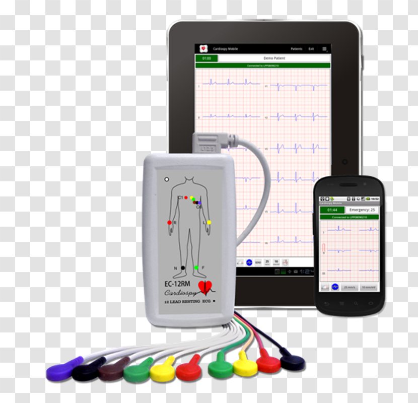 Electrocardiography Electrocardiogram Holter Monitor Cardiac Stress Test Medical Device - Cartoon Transparent PNG