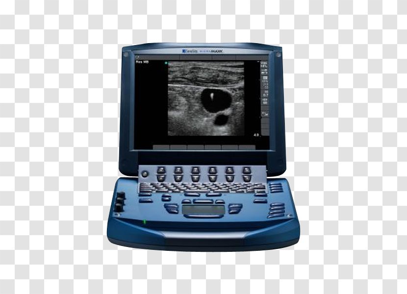 Acuson Ultrasonography Portable Ultrasound SonoSite, Inc. - Electronics - Machine Transparent PNG
