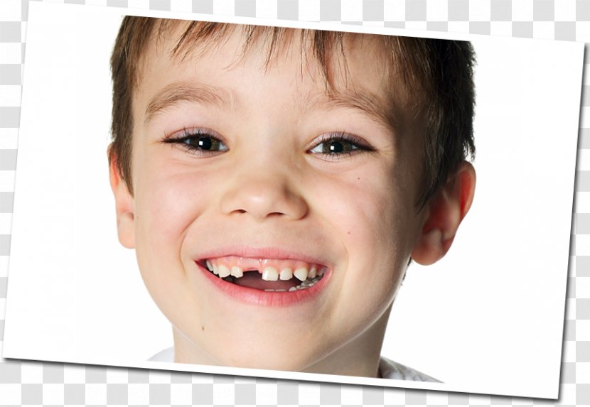 Stock Photography Royalty-free - Flower - Front Teeth Transparent PNG
