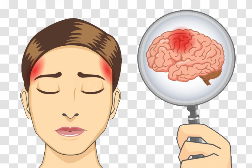 Human Brain Worry Headache Stroke - Cartoon Transparent PNG