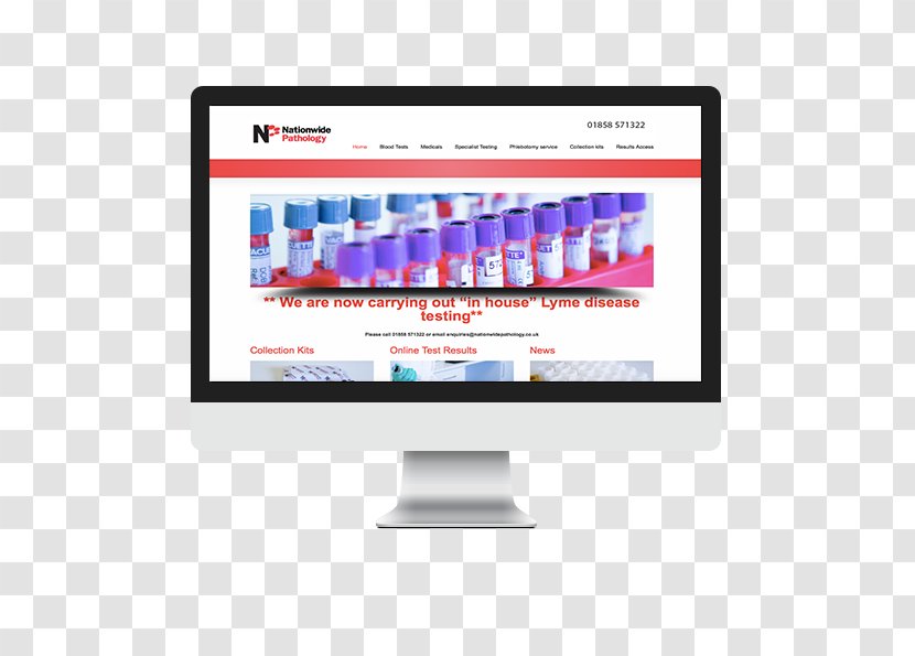 Computer Monitors Display Advertising Web Page Font - Media - Pathology Transparent PNG