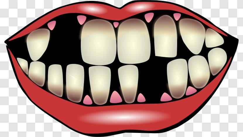 Tooth Pathology Decay Dentistry Clip Art - Cartoon - Bright Teeth Cliparts Transparent PNG