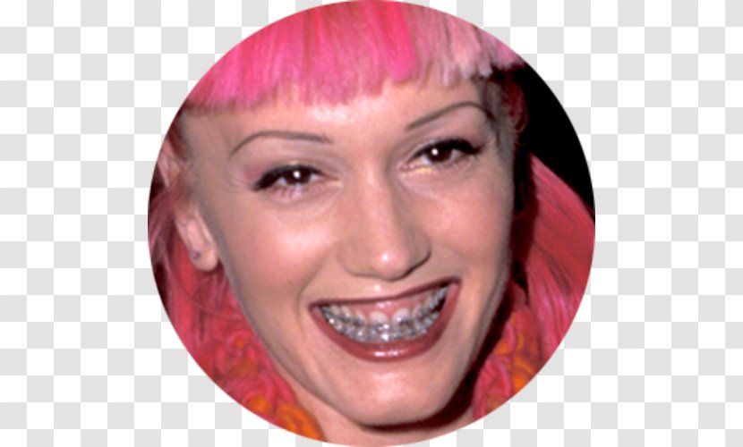 Gwen Stefani Singer-songwriter Celebrity Dental Braces Plastic Surgery - Cartoon - Mouth Smile Transparent PNG