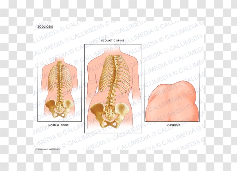 Muscle Bone Organism - Silhouette - Design Transparent PNG