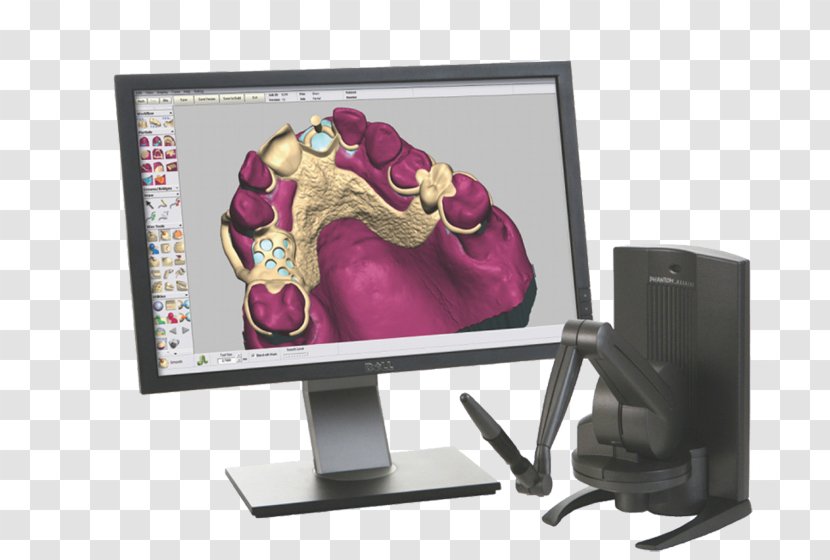 Computer Monitors Bilgisayarlı Tasarım/Bilgisayarlı üretim CAD/CAM Dentistry Computer-aided Design Dentures Transparent PNG