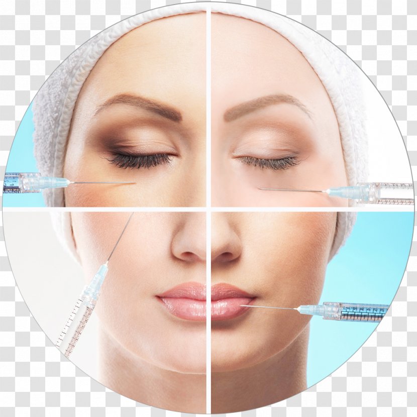 Injectable Filler Dermatology Hyaluronic Acid Wrinkle - Skin - Lip Transparent PNG
