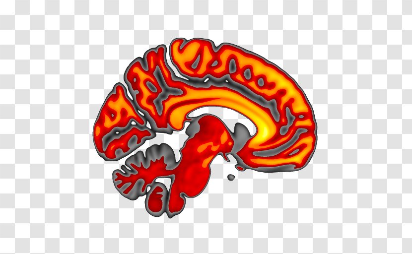FMRIB Software Library Oxford Centre For Functional MRI Of The Brain Visualization Image Illustration - Silhouette - Watercolor Transparent PNG