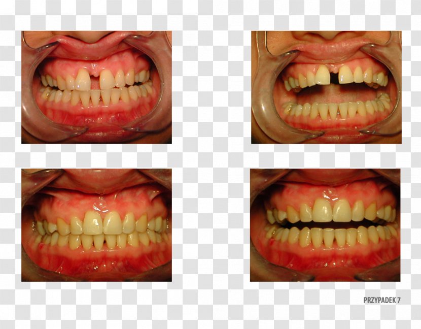 Orange Polska Close-up Therapy - Smile Transparent PNG
