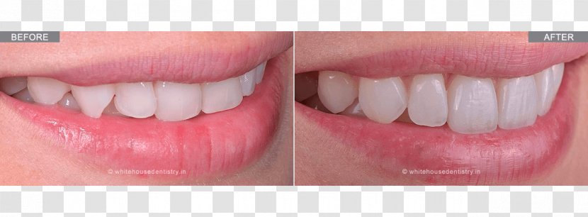 Smile Human Tooth Dentist White House Whitening - Flower - Dental Transparent PNG