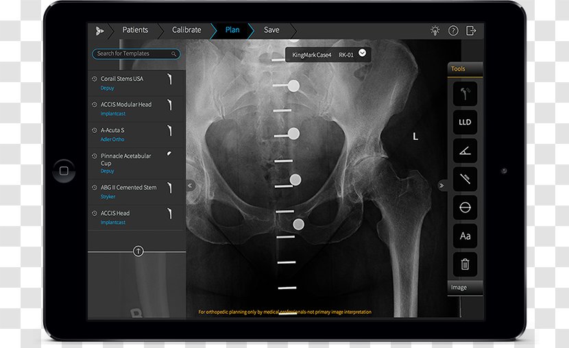 Orthopedic Surgery Computer Software - Radiology - Mobile App Template Transparent PNG