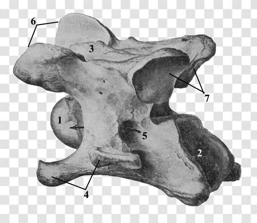 Cervical Vertebrae Axis Anatomy Skull - Cartoon - Heart Transparent PNG